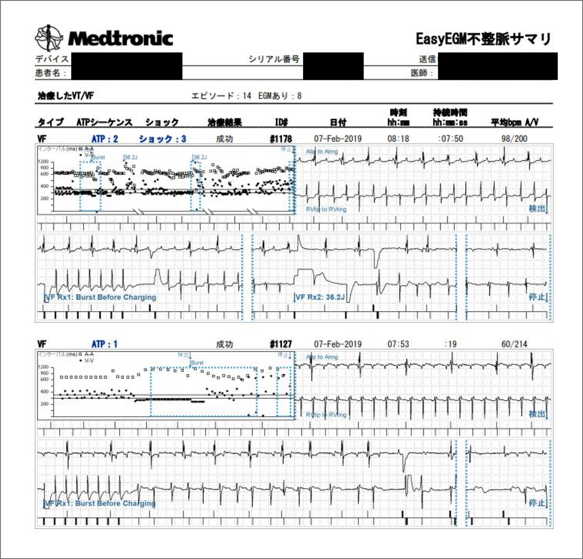 図2：遠隔アラートで受信した, ショック作動を要した心室頻拍症例