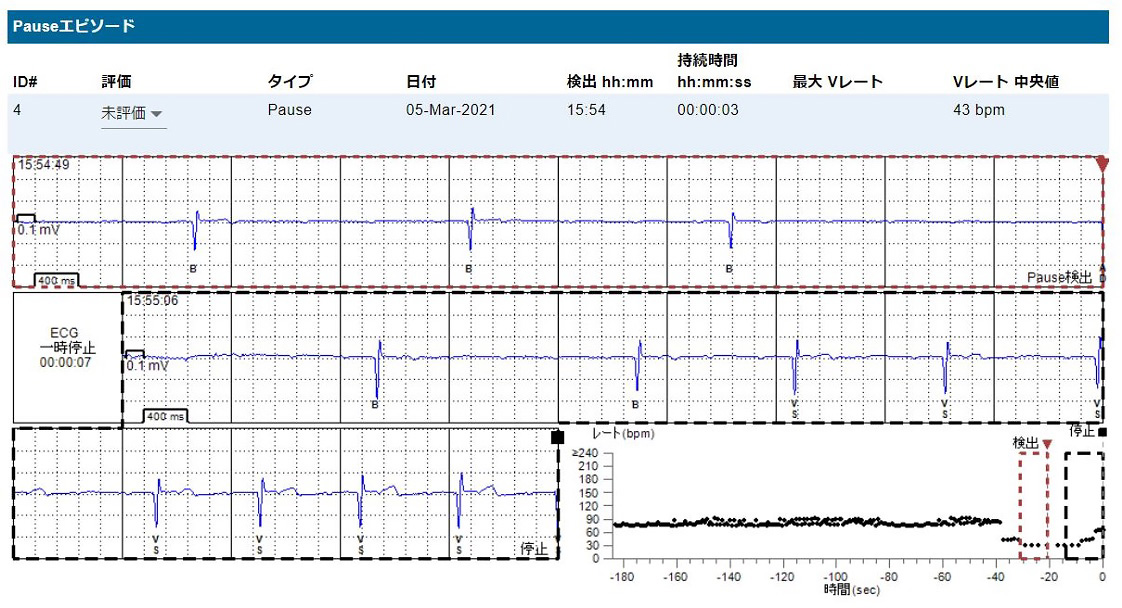 図3 植込み型心臓モニタでのデバイス管理画面のエピソード表示例